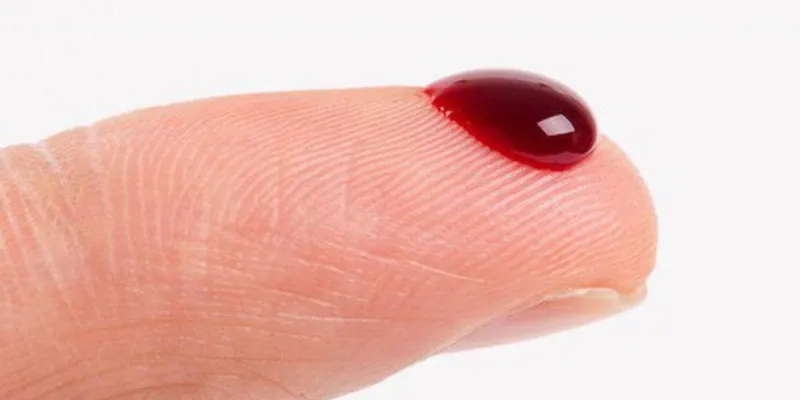 Giấc mơ thấy máu chảy từ miệng